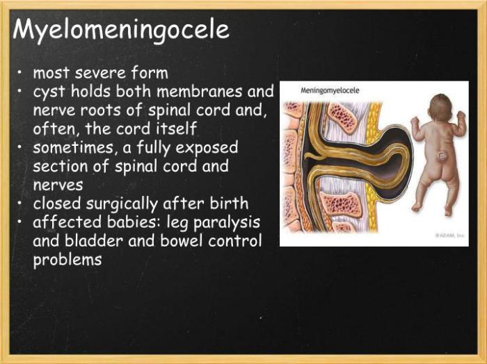 Translate the medical term myelomeningocele as literally as possible.